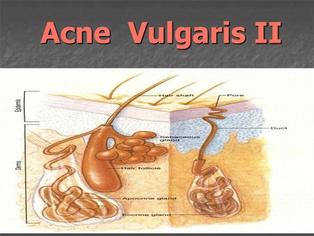 Acne Vulgaris II Acne Vulgaris II. Topical medications Retinoids Retinoids Keratolytics (comedolytics) Keratolytics (comedolytics) Antibiotics Antibiotics.