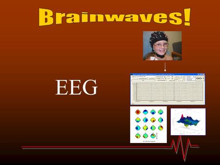 EEG. These are neurons. Your brain has hundreds of billions of them! Diagram of a neuron.A group of real neurons.