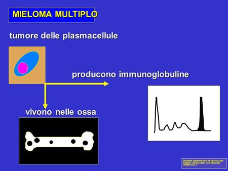 tumore delle plasmacellule