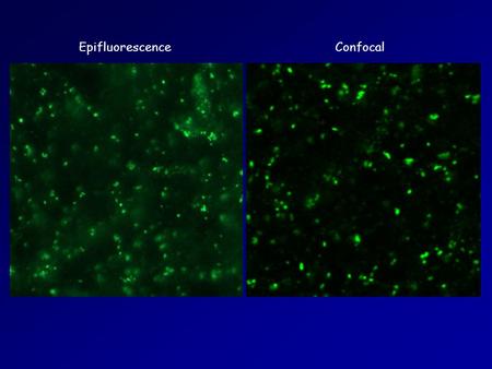 Epifluorescence Confocal. Zoom 1 Zoom 2 Zoom 4.