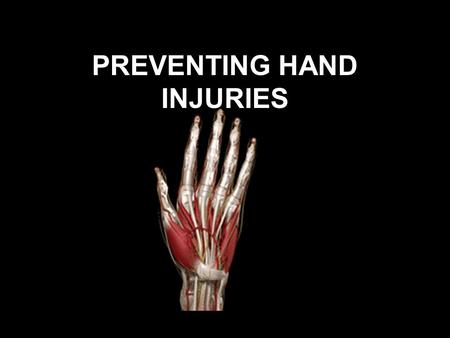 PREVENTING HAND INJURIES