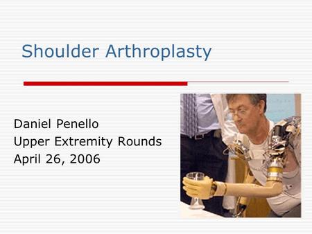 Shoulder Arthroplasty