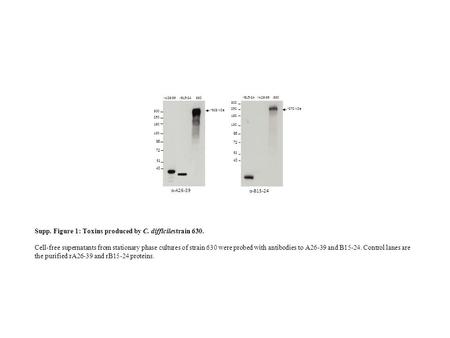 Α-A26-39 rA26-39 rB15-24 630 ~ 270 kDa rB15-24 rA26-39 630 300 250 180 130 95 72 43 52 α-B15-24 300 250 180 130 95 72 43 52 ~ 308 kDa Supp. Figure 1: Toxins.