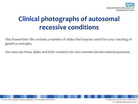 © 2009 NHS National Genetics Education and Development CentreGenetics and Genomics for Healthcare www.geneticseducation.nhs.uk Clinical photographs of.