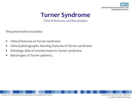 © 2009 NHS National Genetics Education and Development CentreGenetics and Genomics for Healthcare www.geneticseducation.nhs.uk Turner Syndrome Clinical.