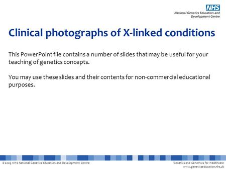 © 2009 NHS National Genetics Education and Development CentreGenetics and Genomics for Healthcare www.geneticseducation.nhs.uk Clinical photographs of.