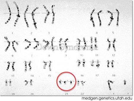 By: Matt Fisher and Alex Rhine Per.6. In 1866 an English doctor named John Langdon Down published a description of the disorder It has been around since.