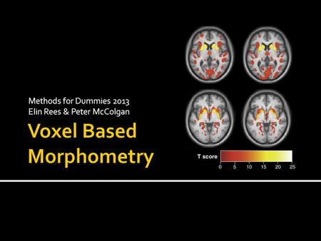 Voxel Based Morphometry