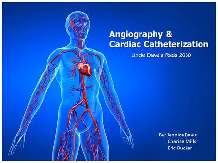 Angiography & Cardiac Catheterization Uncle Dave’s Rads 2030 By: Jennica Davis Charise Mills Eric Bucker.