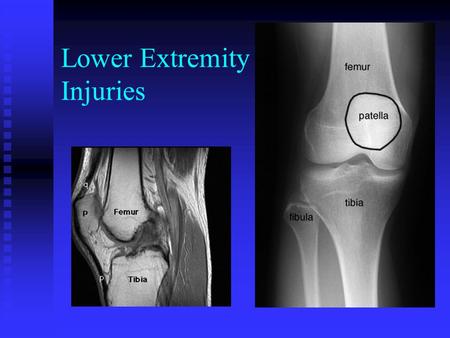 Lower Extremity Injuries