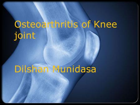 Osteoarthritis of Knee joint Dilshan Munidasa. Overview  Definition and Risk Factors  Idiopathic vs. Secondary OA  Clinical Features  Diagnosis 