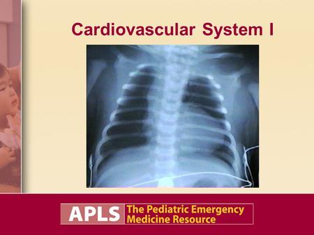 Cardiovascular System I. Objectives Present the clinical features and emergency management of cardiovascular disorders, including: –Recognize congenital.