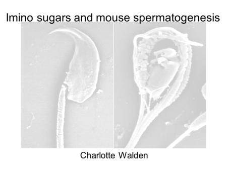 Charlotte Walden Imino sugars and mouse spermatogenesis.