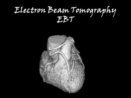 Electron Beam Tomography EBT. I’ve never heard of it, (and it doesn’t sound good) Electrons –Atomic particles –Have mass Wouldn’t a beam of particulate.