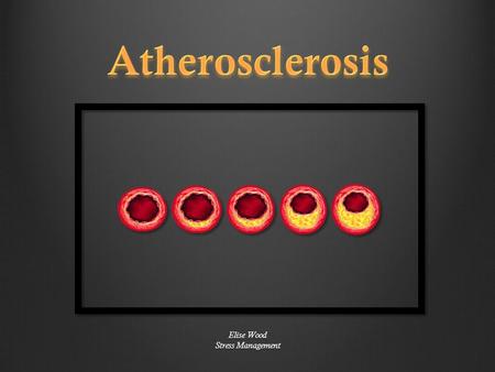 Elise Wood Stress Management. Narrowing of the walls of the arteries Excessive plaque build up Disrupts blood flow Potential cardiovascular complications.