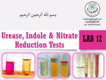 Ureas Test Some bacteria are able to produce an enzyme called urease that attacks the nitrogen and carbon bond in amide compounds such as urea, forming.