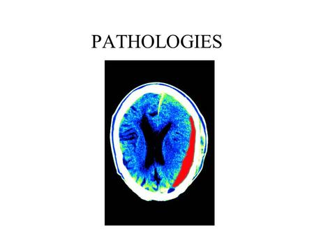 PATHOLOGIES.