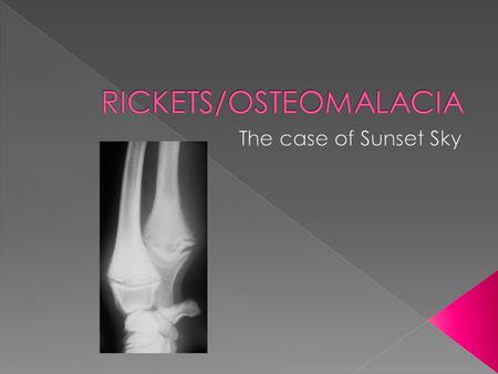 Metabolic Bone Disease Osteolysis (i.e.—hyperparathyroid states) Defective Bone Formation Inadequate mineralization of osteoid (RICKETS) Defective osteoid.