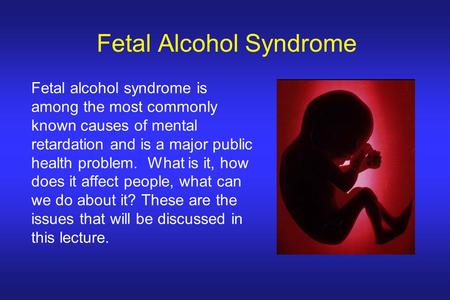 Fetal Alcohol Syndrome Fetal alcohol syndrome is among the most commonly known causes of mental retardation and is a major public health problem. What.