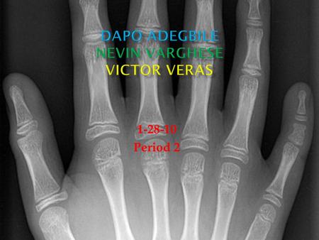 1-28-10 Period 2.  Polydactyly is a condition in which a person has more than five fingers per hand or five toes per foot.  Polydactyly occurs in the.