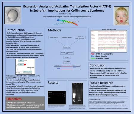 Expression Analysis of Activating Transcription Factor 4 (ATF 4) in Zebrafish: Implications for Coffin-Lowry Syndrome Introduction Objectives Methods Results.