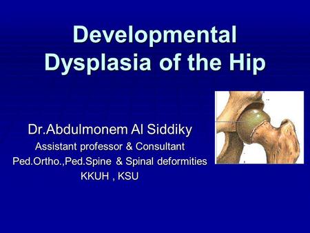 Developmental Dysplasia of the Hip