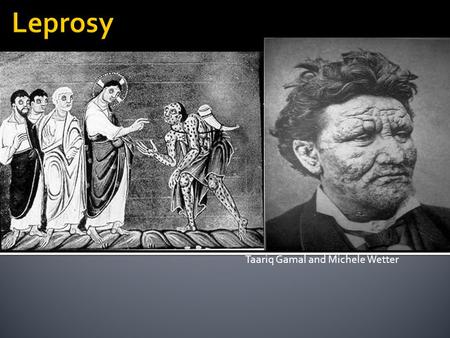 Taariq Gamal and Michele Wetter.  Is an infectious disease that has been around since ancient times. The disease causes skin sores and nerve damage in.