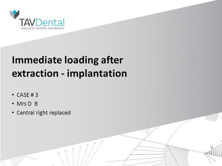 Immediate loading after extraction - implantation