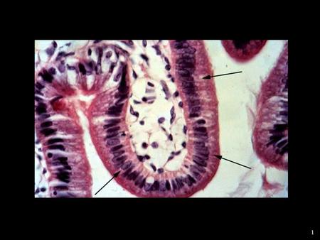 1 Simple columnar epithelium. 2 Hyaline cartilage.