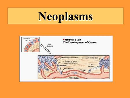 Neoplasms.