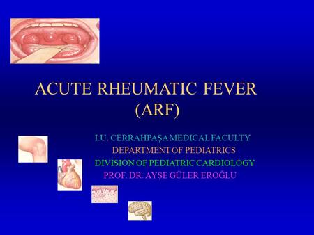 ACUTE RHEUMATIC FEVER (ARF) I.U. CERRAHPAŞA MEDICAL FACULTY DEPARTMENT OF PEDIATRICS DIVISION OF PEDIATRIC CARDIOLOGY PROF. DR. AYŞE GÜLER EROĞLU.