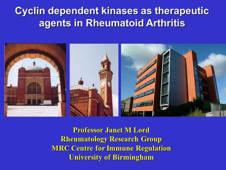 Cyclin dependent kinases as therapeutic agents in Rheumatoid Arthritis