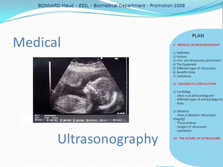 Medical Ultrasonography PLAN BONNARD Maud – ESIL - Biomedical Department - Promotion 2008 I/ MEDICAL ULTRASONOGRAPHY 1/ Definition 2/ Historic 3/ How are.