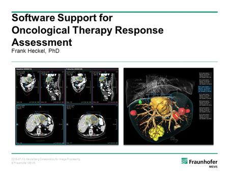 © Fraunhofer MEVIS 2015-07-13, Heidelberg Collaboratory for Image Processing Frank Heckel, PhD Software Support for Oncological Therapy Response Assessment.