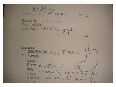 GASTRIC LYMPHOMAS Aswad H. Al.Obeidy FICMS, FICMS GE&Hep Kirkuk General Hospital.