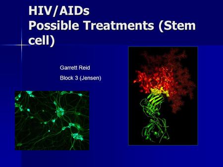 HIV/AIDs Possible Treatments (Stem cell) Garrett Reid Block 3 (Jensen)