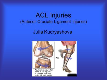 ACL Injuries (Anterior Cruciate Ligament Injuries)