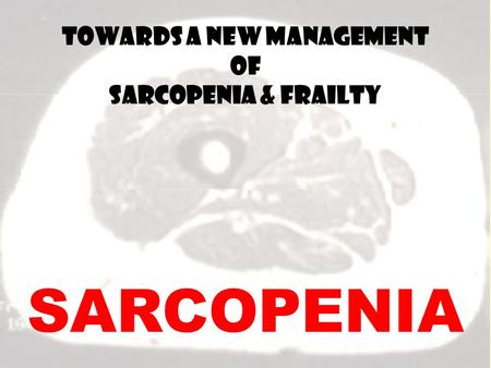 SARCOPENIA Towards a new management of sarcopenia & frailty.