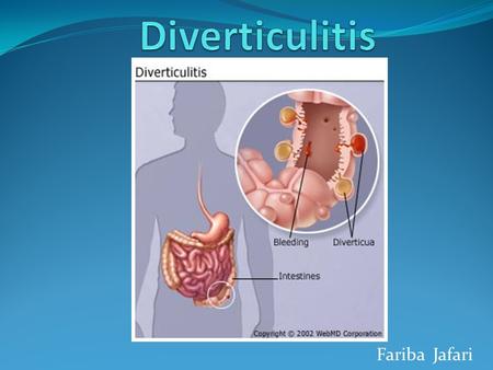 Fariba Jafari. Definition Outpouchings of the colon Located at sites where blood vessels enter the colonic wall Inflamed as a result of obstruction by.