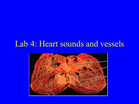 Lab 4: Heart sounds and vessels. Overview Review Heart sounds Blood supply to the heart Blood vessels –Veins Portal systems New lab website: