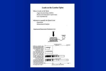 In Vivo Loads on the Lumbar Spine Standing and walking activities:	1000 N Supine posture: ~250 N Standing at ease: ~500 N Lifting activities:				>>