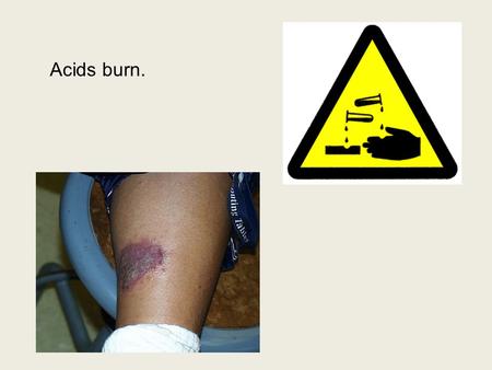 Acids burn.. Bases burn. VI. Strength of Acids and Bases A. Strong acids and bases… 1. completely dissociate (come apart) or ionizes  100% of the molecules.