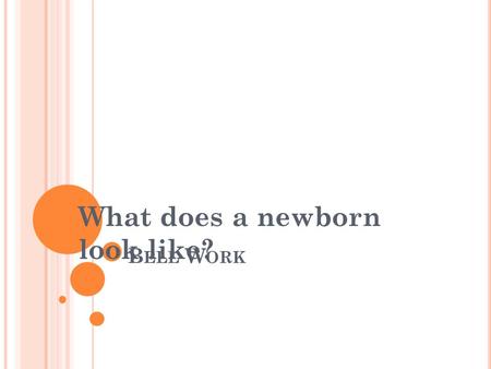 B ELL W ORK What does a newborn look like? B ELL Q UIZ #1 1. Fontanelles: A. Are signs of a birth defect affecting the baby’s bones B. Cause the baby’s.