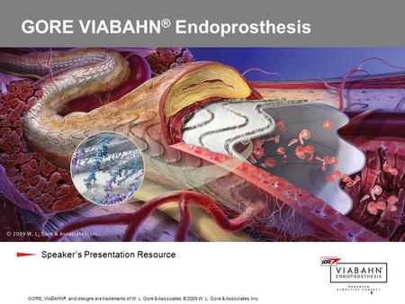 GORE, VIABAHN ®, and designs are trademarks of W. L. Gore & Associates. © 2009 W. L. Gore & Associates, Inc. 1 GORE VIABAHN ® Endoprosthesis Speaker’s.