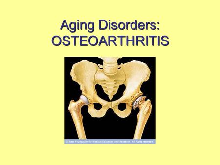 Aging Disorders: OSTEOARTHRITIS