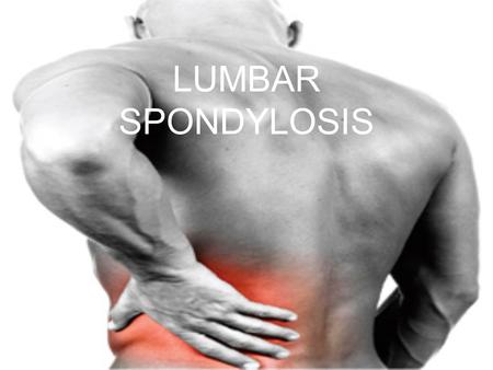 LUMBAR SPONDYLOSIS.