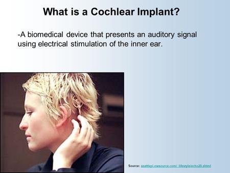 What is a Cochlear Implant?