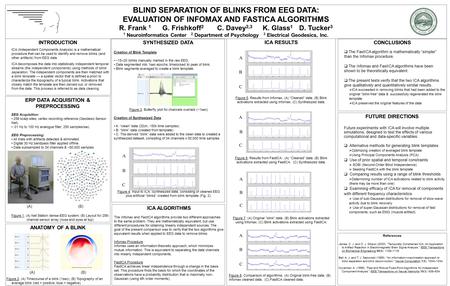 ERP DATA ACQUISITION & PREPROCESSING EEG Acquisition: 256 scalp sites; vertex recording reference (Geodesic Sensor Net)..01 Hz to 100 Hz analogue filter;