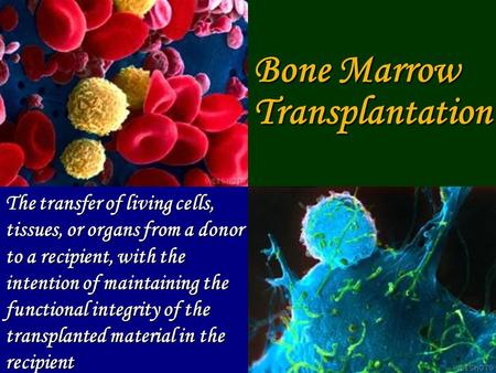 Bone Marrow Transplantation The transfer of living cells, tissues, or organs from a donor to a recipient, with the.