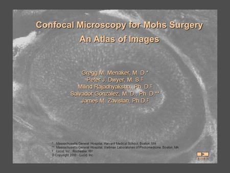 Gregg M. Menaker, M. D.* Peter J. Dwyer, M. S. ‡ Milind Rajadhyaksha, Ph. D. ‡ Salvador González, M. D., Ph. D.** James M. Zavislan, Ph.D. ‡ Confocal Microscopy.